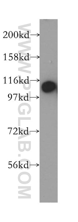 RABEP1 Rabbit anti-Human, Mouse, Rat, Polyclonal, Proteintech:Antibodies:Primary