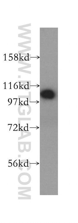 RABEP1 Rabbit anti-Human, Mouse, Rat, Polyclonal, Proteintech:Antibodies:Primary