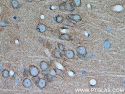 PKC gamma Rabbit anti-Human, Mouse, Rat, Polyclonal, Proteintech 20 &mu;L | Buy Online | Proteintech | Fisher Scientific