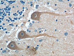 PKC gamma Rabbit anti-Human, Mouse, Rat, Polyclonal, Proteintech 20 &mu;L | Buy Online | Proteintech | Fisher Scientific