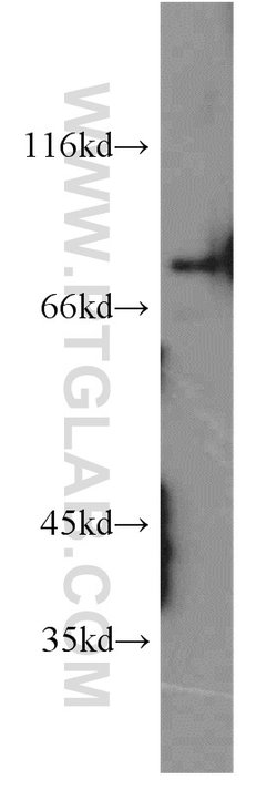 PKC gamma Rabbit anti-Human, Mouse, Rat, Polyclonal, Proteintech 20 &mu;L | Buy Online | Proteintech | Fisher Scientific