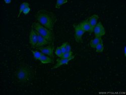 FAM175A Rabbit anti-Human, Mouse, Rat, Polyclonal, Proteintech 150 &mu;L;