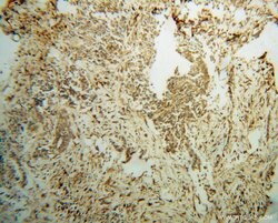 FAM175A Rabbit anti-Human, Mouse, Rat, Polyclonal, Proteintech 150 &mu;L;