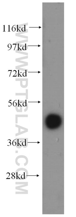 FAM175A Rabbit anti-Human, Mouse, Rat, Polyclonal, Proteintech 150 &mu;L;
