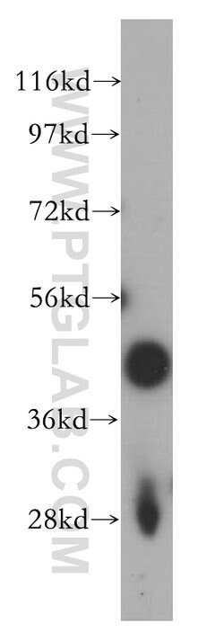 FAM175A Rabbit anti-Human, Mouse, Rat, Polyclonal, Proteintech 150 &mu;L;
