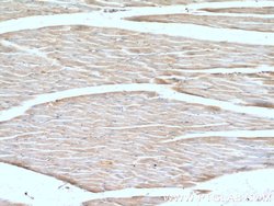 PSMA2 Rabbit anti-Human, Mouse, Rat, Polyclonal, Proteintech:Antibodies:Primary