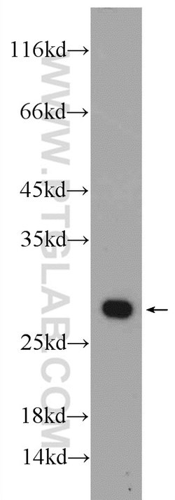 PSMA2 Rabbit anti-Human, Mouse, Rat, Polyclonal, Proteintech:Antibodies:Primary
