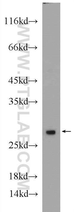 PSMA2 Rabbit anti-Human, Mouse, Rat, Polyclonal, Proteintech:Antibodies:Primary