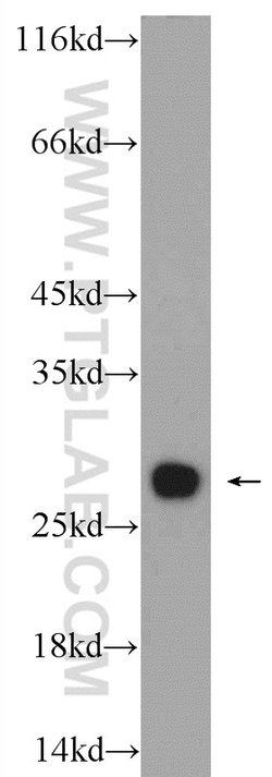 PSMA2 Rabbit anti-Human, Mouse, Rat, Polyclonal, Proteintech:Antibodies:Primary