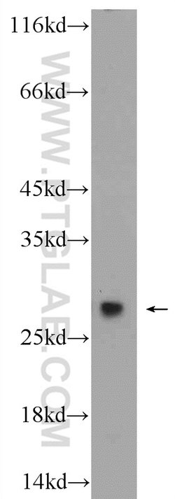 PSMA2 Rabbit anti-Human, Mouse, Rat, Polyclonal, Proteintech:Antibodies:Primary