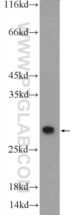 PSMA2 Rabbit anti-Human, Mouse, Rat, Polyclonal, Proteintech:Antibodies:Primary