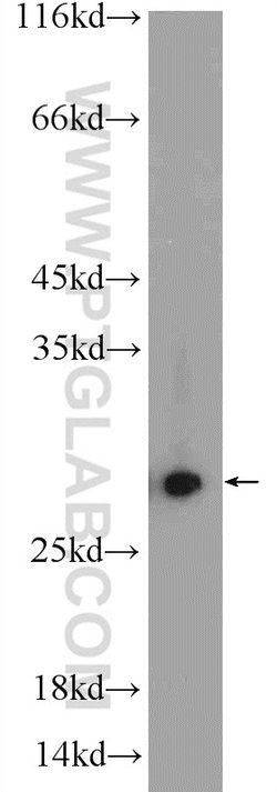PSMA2 Rabbit anti-Human, Mouse, Rat, Polyclonal, Proteintech:Antibodies:Primary