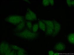 CDT1 Rabbit anti-Human, Polyclonal, Proteintech 150 &mu;L; Unconjugated:Antibodies,