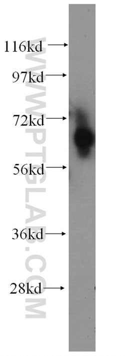 CDT1 Rabbit anti-Human, Polyclonal, Proteintech 150 &mu;L; Unconjugated:Antibodies,