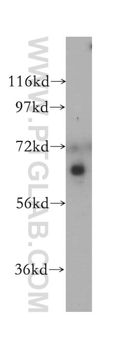 CDT1 Rabbit anti-Human, Polyclonal, Proteintech 150 &mu;L; Unconjugated:Antibodies,