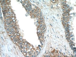 PASK Rabbit anti-Human, Mouse, Rat, Polyclonal, Proteintech:Antibodies:Primary