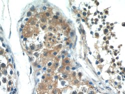 PASK Rabbit anti-Human, Mouse, Rat, Polyclonal, Proteintech:Antibodies:Primary