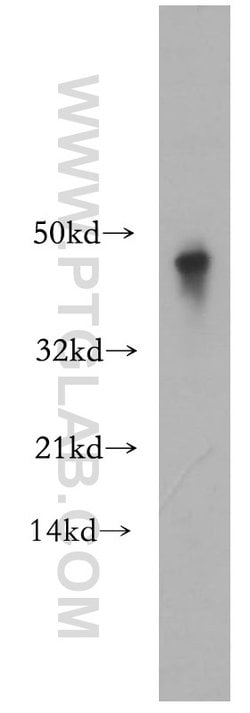 SCPx Rabbit anti-Human, Mouse, Rat, Polyclonal, Proteintech:  