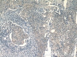 TRAF3IP1 Rabbit anti-Human, Mouse, Rat, Polyclonal, Proteintech:Antibodies:Primary