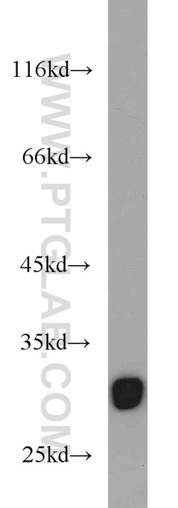 ITM2A Rabbit anti-Human, Mouse, Rat, Polyclonal, Proteintech:Antibodies:Primary