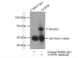 NOP58 Rabbit anti-Human, Mouse, Rat, Polyclonal, Proteintech 150 &mu;L;