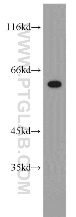 NOP58 Rabbit anti-Human, Mouse, Rat, Polyclonal, Proteintech 150 &mu;L;