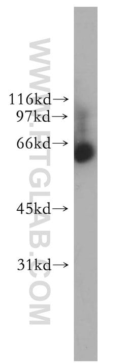 NOP58 Rabbit anti-Human, Mouse, Rat, Polyclonal, Proteintech 150 &mu;L;