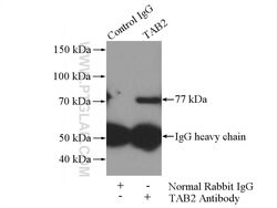 TAB2 Rabbit anti-Human, Mouse, Rat, Polyclonal, Proteintech:Antibodies:Primary