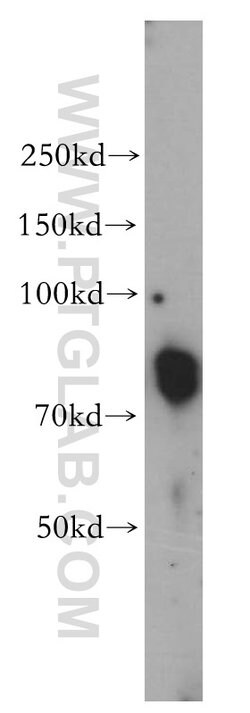 TAB2 Rabbit anti-Human, Mouse, Rat, Polyclonal, Proteintech:Antibodies:Primary