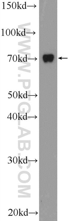 TAB2 Rabbit anti-Human, Mouse, Rat, Polyclonal, Proteintech:Antibodies:Primary