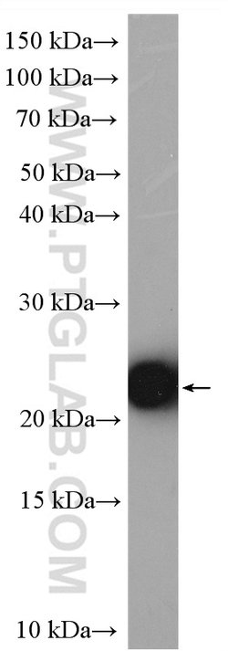 MOCS2 Rabbit anti-Human, Mouse, Rat, Polyclonal, Proteintech 150 &mu;L;
