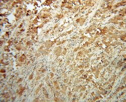 NDUFS6 Rabbit anti-Human, Mouse, Rat, Polyclonal, Proteintech:Antibodies:Primary