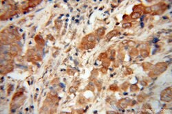 NDUFS6 Rabbit anti-Human, Mouse, Rat, Polyclonal, Proteintech:Antibodies:Primary