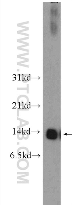 NDUFS6 Rabbit anti-Human, Mouse, Rat, Polyclonal, Proteintech:Antibodies:Primary
