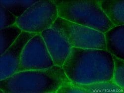 ATP1A1 Rabbit anti-Human, Mouse, Rat, Polyclonal, Proteintech 150 &mu;L | Buy Online | Proteintech | Fisher Scientific