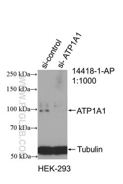 ATP1A1 Rabbit anti-Human, Mouse, Rat, Polyclonal, Proteintech 150 &mu;L | Buy Online | Proteintech | Fisher Scientific