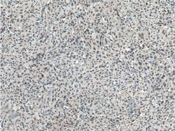 TCF12/HEB Rabbit anti-Human, Mouse, Rat, Polyclonal, Proteintech:Anticuerpos:Anticuerpos