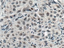 TCF12/HEB Rabbit anti-Human, Mouse, Rat, Polyclonal, Proteintech:Anticuerpos:Anticuerpos