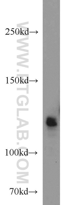 RBM10 Rabbit anti-Human, Mouse, Rat, Polyclonal, Proteintech:Antibodies:Primary