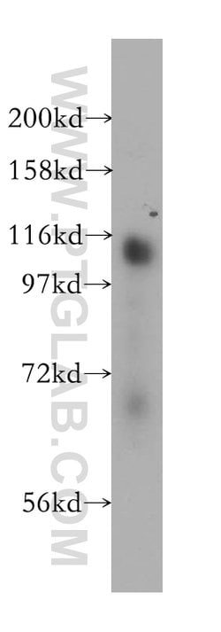 RBM10 Rabbit anti-Human, Mouse, Rat, Polyclonal, Proteintech:Antibodies:Primary