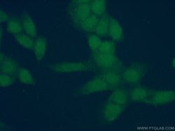 AMPK beta 2 Rabbit anti-Human, Mouse, Polyclonal, Proteintech:Anticuerpos:Anticuerpos