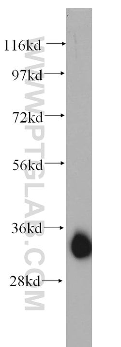 AMPK beta 2 Rabbit anti-Human, Mouse, Polyclonal, Proteintech:Anticuerpos:Anticuerpos