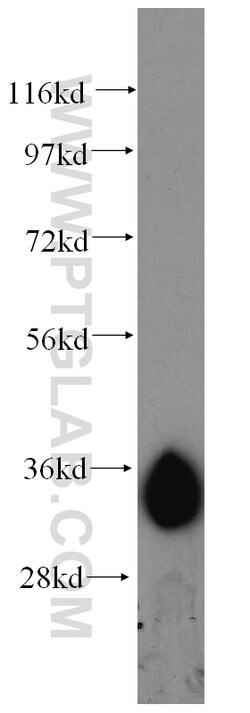 AMPK beta 2 Rabbit anti-Human, Mouse, Polyclonal, Proteintech:Anticuerpos:Anticuerpos