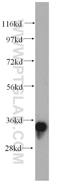 AMPK beta 2 Rabbit anti-Human, Mouse, Polyclonal, Proteintech:Anticuerpos:Anticuerpos