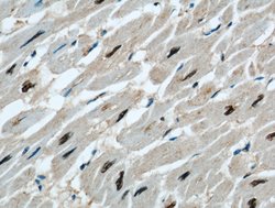 STK17A Rabbit anti-Human, Mouse, Polyclonal, Proteintech:Antibodies:Primary