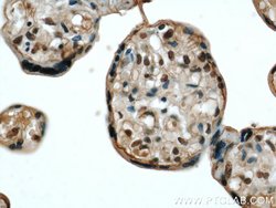 STK17A Rabbit anti-Human, Mouse, Polyclonal, Proteintech:Antibodies:Primary
