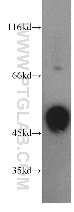 STK17A Rabbit anti-Human, Mouse, Polyclonal, Proteintech:Antibodies:Primary