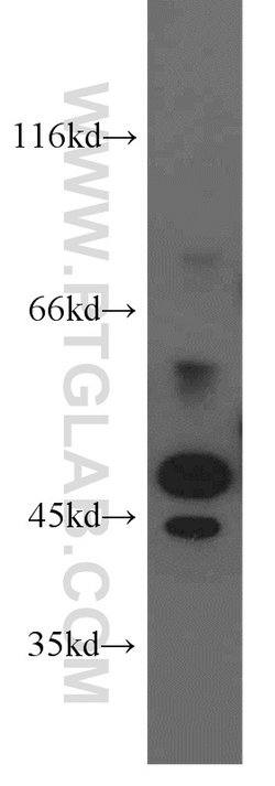 STK17A Rabbit anti-Human, Mouse, Polyclonal, Proteintech:Antibodies:Primary