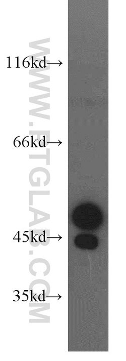 STK17A Rabbit anti-Human, Mouse, Polyclonal, Proteintech:Antibodies:Primary