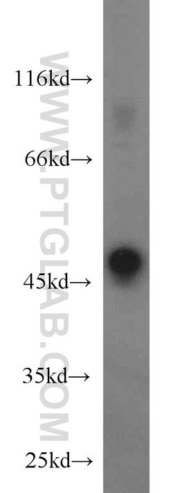 STK17A Rabbit anti-Human, Mouse, Polyclonal, Proteintech:Antibodies:Primary